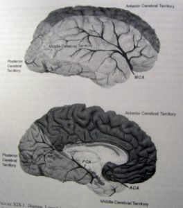 Head injury Secondary Lesions